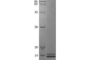 Validation with Western Blot (SPINK1 Protein)