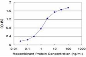 Detection limit for recombinant GST tagged TARBP2 is approximately 0. (TARBP2 antibody  (AA 141-250))