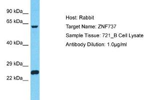 Host: Rabbit Target Name: ZNF737 Sample Type: 721_B Whole Cell lysates Antibody Dilution: 1. (ZNF737 antibody  (N-Term))