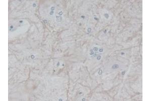 Detection of FGFR1 in Rat Spinal cord Tissue using Polyclonal Antibody to Fibroblast Growth Factor Receptor 1 (FGFR1) (FGFR1 antibody  (AA 22-376))