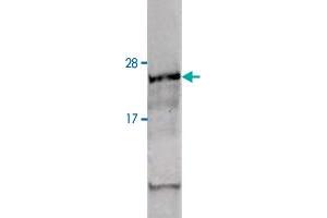 Western blot analysis of hydrogen peroxide stimulated human derived MCF-7 whole cell lysate with ATM (phospho S1981) polyclonal antibody . (ATM antibody  (pSer1981))