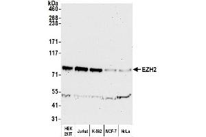 Western Blotting (WB) image for anti-Enhancer of Zeste Homolog 2 (EZH2) (AA 696-746) antibody (ABIN7450991) (EZH2 antibody  (AA 696-746))
