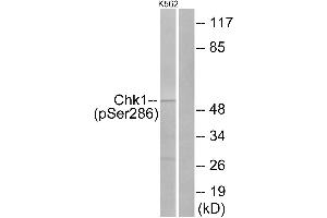 Western blot analysis of extracts from K562 cells, treated with Na3VO4 (0. (CHEK1 antibody  (pSer286))