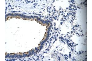Rabbit Anti-ANKRD12 Antibody       Paraffin Embedded Tissue:  Human cilia   Cellular Data:  Epithelial cells of renal tubule  Antibody Concentration:   4. (Asialoglycoprotein Receptor 2 antibody  (N-Term))