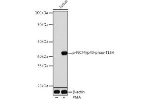 Western blot analysis of extracts of Jurkat cells, using Phospho-NCF4/p40-phox-T154 antibody (ABIN7268901) at 1:1000 dilution. (NCF4 antibody  (pThr154))