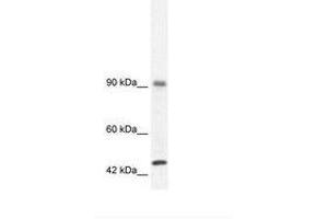 Image no. 3 for anti-RNA Binding Motif Protein 10 (RBM10) (AA 39-88) antibody (ABIN202954) (RBM10 antibody  (AA 39-88))