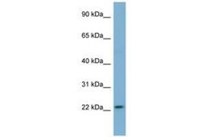 Image no. 1 for anti-Microfibrillar Associated Protein 2 (MFAP2) (N-Term) antibody (ABIN6741719) (MFAP2 antibody  (N-Term))