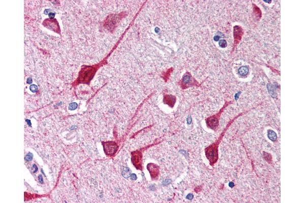 NLRP1 antibody  (C-Term)