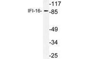 Western blot (WB) analysis of IFI-16 antibody in extracts from HepG2 cells.