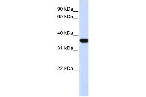 WB Suggested Anti-HMOX1 Antibody Titration: 0. (HMOX1 antibody  (N-Term))