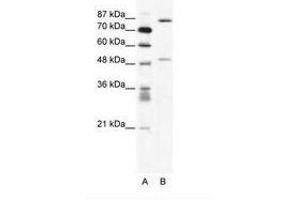 Image no. 1 for anti-Matrix Metallopeptidase 10 (Stromelysin 2) (MMP10) (N-Term) antibody (ABIN202622) (MMP10 antibody  (N-Term))