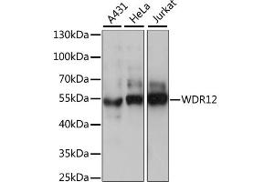Western blot analysis of extracts of various cell lines, using WDR12 antibody. (WDR12 antibody)
