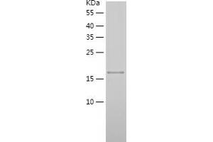 Western Blotting (WB) image for Noggin (NOG) (AA 28-232) protein (His tag) (ABIN7286859) (NOG Protein (AA 28-232) (His tag))