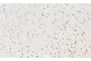 Immunohistochemistry analysis of paraffin-embedded Rat brain using NOS1 Polyclonal Antibody at dilution of 1:300. (NOS1 antibody)