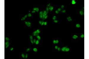 Immunofluorescent analysis of HepG2 cells using nacHU at dilution of 1:100 and Alexa Fluor 488-congugated AffiniPure Goat Anti-Rabbit IgG(H+L) (Histone H1.1 antibody)