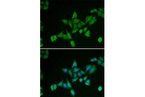 Immunofluorescence analysis of HeLa cells using BNIP2 antibody (ABIN5973707). (BNIP2 antibody)