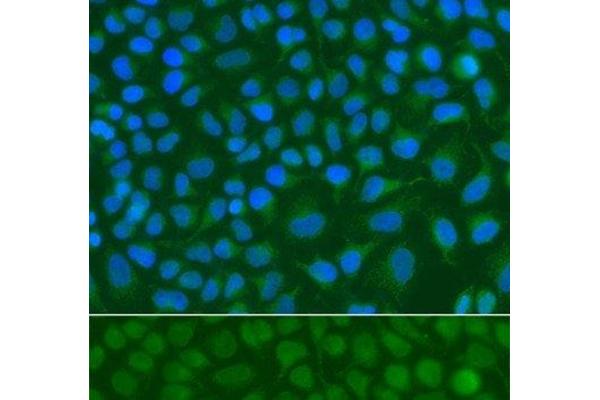SSX5 antibody