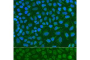 Immunofluorescence analysis of A549 cells using SSX5 Polyclonal Antibody (SSX5 antibody)