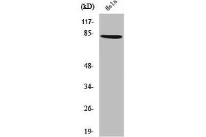 ZNF225 Antikörper  (C-Term)