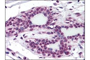 Image no. 1 for anti-Zinc Finger, MYM-Type 2 (ZMYM2) (AA 1250-1300) antibody (ABIN372247) (ZMYM2 antibody  (AA 1250-1300))