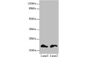 Western blot All lanes: FKBP11 antibody at 6 μg/mL Lane 1: Mouse spleen tissue Lane 2: Mouse liver tissue Secondary Goat polyclonal to rabbit IgG at 1/10000 dilution Predicted band size: 23, 16 kDa Observed band size: 23 kDa