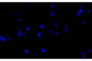 Immunofluorescence staining of Hela cells with(ABIN7153642)at 1:50, counter-stained with DAPI. (GAPDH antibody  (AA 2-335))