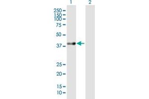 Western Blot analysis of ACAT2 expression in transfected 293T cell line by ACAT2 MaxPab polyclonal antibody. (ACAT2 antibody  (AA 1-397))