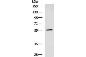 Western blot analysis of A549 cell lysate using CEP57 Polyclonal Antibody at dilution of 1:600