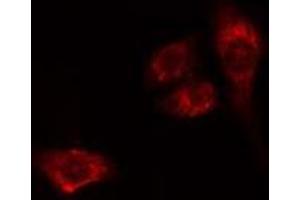 ABIN6275534 staining HeLa cells by IF/ICC. (PLK2 antibody  (Internal Region))