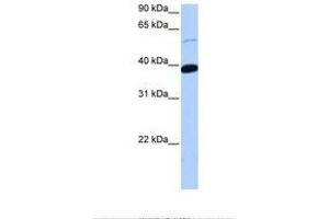 Image no. 1 for anti-Zinc Finger Protein 562 (ZNF562) (AA 176-225) antibody (ABIN6738774)