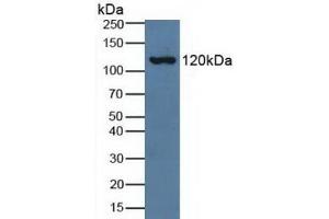 Detection of C3a in Human Serum using Polyclonal Antibody to Complement Component 3a (C3a) (C3a antibody  (AA 672-748))