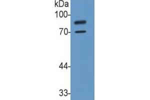 Rabbit Capture antibody from the kit in WB with Positive Control: Sample Human U937 Cells. (Integrin beta 2 ELISA Kit)