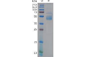 Glycoprotein Ib (Platelet), beta Polypeptide (GP1BB) (AA 27-147) protein (Fc Tag)