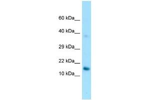 WB Suggested Anti-GPIHBP1 Antibody Titration: 1. (GPIHBP1 antibody  (C-Term))