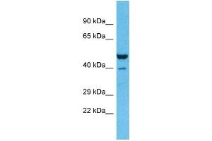 Host:  Rabbit  Target Name:  ZNF589  Sample Type:  Lung Tumor lysates  Antibody Dilution:  1. (ZNF589 antibody  (C-Term))