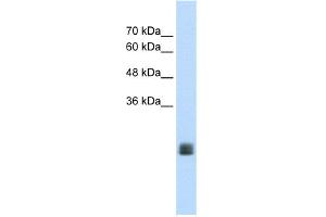 WB Suggested Anti-MGC33926 Antibody Titration:  1.