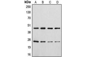 Western blot analysis of CD28 (pY218) expression in HeLa colchicine-treated (A), Jurkat (B), Raw264. (CD28 antibody  (C-Term, pTyr218))