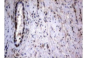 Image no. 2 for anti-RAS Guanyl Releasing Protein 3 (Calcium and DAG-Regulated) (RASGRP3) (AA 380-690) antibody (ABIN1491477) (RASGRP3 antibody  (AA 380-690))
