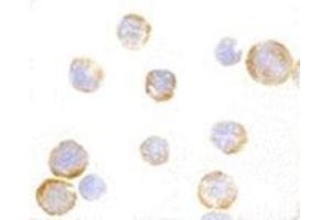 Immunocytochemistry of TLR3 in EL4 cells with CD283 / TLR3 antibody at 1 µg/ml. (TLR3 antibody  (C-Term))