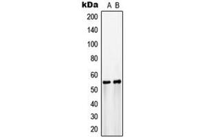 Western blot analysis of GLUT3 expression in COLO205 (A), HepG2 (B) whole cell lysates. (SLC2A3 antibody  (C-Term))