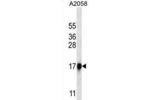 Western Blotting (WB) image for anti-Chymotrypsin-Like Elastase Family, Member 1 (CELA1) antibody (ABIN2999709) (CELA1 antibody)