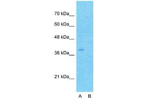 Host:  Rabbit  Target Name:  CYTB  Sample Type:  MCF7  Lane A:  Primary Antibody  Lane B:  Primary Antibody + Blocking Peptide  Primary Antibody Concentration:  1ug/ml  Peptide Concentration:  5ug/ml  Lysate Quantity:  25ug/lane/lane  Gel Concentration:  0.