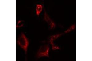 ABIN6275642 staining Hela cells by IF/ICC. (EIF2B3 antibody  (Internal Region))