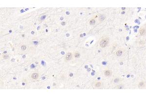 Immunohistochemistry (IHC) image for anti-5'-3' Exoribonuclease 1 (XRN1) (AA 1394-1706) antibody (ABIN7445129)