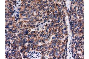 Image no. 4 for anti-Family with Sequence Similarity 127, Member C (FAM127C) antibody (ABIN1498197) (FAM127C antibody)