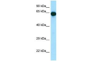 Western Blotting (WB) image for anti-UTP15, U3 Small Nucleolar Ribonucleoprotein, Homolog (UTP15) (Middle Region) antibody (ABIN2788479) (UTP15 antibody  (Middle Region))