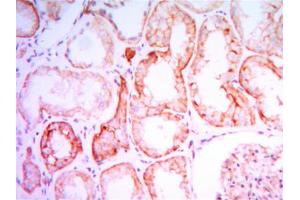 Immunohistochemical analysis of paraffin-embedded human kidney tissues using PTH1R mouse mAb with DAB staining.