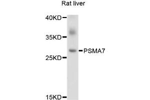 Western blot analysis of extracts of Rat liver cells, using PSMA7 antibody. (PSMA7 antibody)