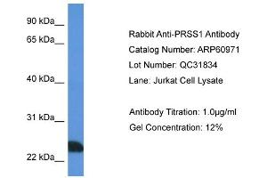Western Blotting (WB) image for anti-Protease, serine, 1 (Trypsin 1) (PRSS1) (N-Term) antibody (ABIN2788638) (PRSS1 antibody  (N-Term))