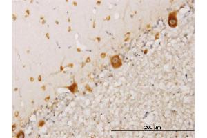 Immunoperoxidase of monoclonal antibody to RPS17 on formalin-fixed paraffin-embedded human cerebellum. (RPS17 antibody  (AA 36-135))